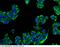 Keratin 8 antibody, 100583-T46, Sino Biological, Immunohistochemistry paraffin image 