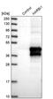 Harbinger Transposase Derived 1 antibody, PA5-58490, Invitrogen Antibodies, Western Blot image 