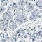 Ecdysoneless Cell Cycle Regulator antibody, HPA006465, Atlas Antibodies, Immunohistochemistry paraffin image 