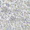 Proline Dehydrogenase 1 antibody, A5836, ABclonal Technology, Immunohistochemistry paraffin image 