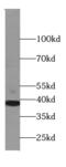 Stomatin-like protein 2 antibody, FNab08347, FineTest, Western Blot image 