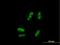 SSX Family Member 5 antibody, H00006758-B01P, Novus Biologicals, Immunocytochemistry image 