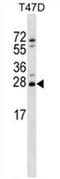 Zinc Finger Matrin-Type 2 antibody, AP54657PU-N, Origene, Western Blot image 
