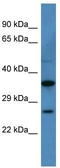 Calcium Voltage-Gated Channel Auxiliary Subunit Gamma 1 antibody, TA344183, Origene, Western Blot image 