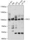 DSC2 antibody, A03205, Boster Biological Technology, Western Blot image 
