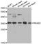Protein Kinase AMP-Activated Non-Catalytic Subunit Beta 2 antibody, A6952, ABclonal Technology, Western Blot image 