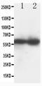 DNA nucleotidylexotransferase antibody, PA1227, Boster Biological Technology, Western Blot image 