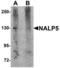 NACHT, LRR and PYD domains-containing protein 5 antibody, LS-C115897, Lifespan Biosciences, Western Blot image 