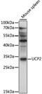 Uncoupling Protein 2 antibody, 19-299, ProSci, Western Blot image 