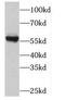 Polo Like Kinase 5 antibody, FNab06551, FineTest, Western Blot image 