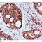 RAD23 Homolog B, Nucleotide Excision Repair Protein antibody, LS-C812991, Lifespan Biosciences, Immunohistochemistry paraffin image 