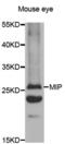 Major Intrinsic Protein Of Lens Fiber antibody, abx002119, Abbexa, Western Blot image 