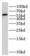 Propionyl-CoA Carboxylase Subunit Beta antibody, FNab06193, FineTest, Western Blot image 