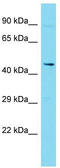 Delta Like Non-Canonical Notch Ligand 2 antibody, TA338637, Origene, Western Blot image 