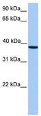 Casein Kinase 2 Alpha 1 antibody, TA335861, Origene, Western Blot image 