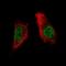 AT-Rich Interaction Domain 1A antibody, NBP2-61623, Novus Biologicals, Immunofluorescence image 