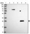 Spindlin Family Member 4 antibody, NBP1-93750, Novus Biologicals, Western Blot image 
