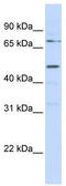 Kringle Containing Transmembrane Protein 1 antibody, TA335993, Origene, Western Blot image 