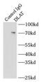 Dihydrolipoamide S-Acetyltransferase antibody, FNab02404, FineTest, Immunoprecipitation image 