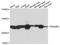 Zinc Finger RANBP2-Type Containing 3 antibody, STJ113657, St John