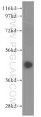 Inhibitor of growth protein 3 antibody, 16187-1-AP, Proteintech Group, Western Blot image 