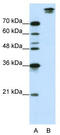 SF3b155 antibody, TA343787, Origene, Western Blot image 
