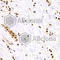 hRAD50 antibody, A3078, ABclonal Technology, Immunohistochemistry paraffin image 