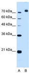 Corin, Serine Peptidase antibody, TA341848, Origene, Western Blot image 