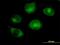RAB GTPase Activating Protein 1 antibody, H00023637-B01P, Novus Biologicals, Immunofluorescence image 