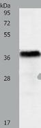 PiggyBac Transposable Element Derived 2 antibody, TA323420, Origene, Western Blot image 