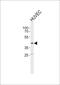 Oxidized Low Density Lipoprotein Receptor 1 antibody, PA5-72586, Invitrogen Antibodies, Western Blot image 