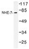 Solute Carrier Family 9 Member A7 antibody, AP01502PU-N, Origene, Western Blot image 