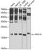 Regulator Of G Protein Signaling 10 antibody, GTX64712, GeneTex, Western Blot image 