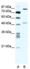 Stromelysin-2 antibody, TA330400, Origene, Western Blot image 