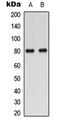 Solute Carrier Family 5 Member 3 antibody, LS-C358323, Lifespan Biosciences, Western Blot image 