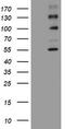 ALK Receptor Tyrosine Kinase antibody, CF801412, Origene, Western Blot image 