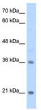 Transcription Factor 15 antibody, TA343480, Origene, Western Blot image 