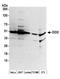 DNA Damage Inducible 1 Homolog 2 antibody, A304-630A, Bethyl Labs, Western Blot image 