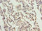 ERCC Excision Repair 6 Like 2 antibody, LS-C396097, Lifespan Biosciences, Immunohistochemistry paraffin image 