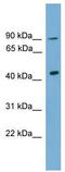Doublesex And Mab-3 Related Transcription Factor 1 antibody, TA342315, Origene, Western Blot image 