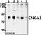 Cyclic Nucleotide Gated Channel Alpha 1 antibody, A05494-2, Boster Biological Technology, Western Blot image 