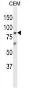 Zinc Finger Protein 160 antibody, AP54660PU-N, Origene, Western Blot image 