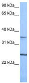 Phosphatidylinositol Glycan Anchor Biosynthesis Class F antibody, TA345804, Origene, Western Blot image 