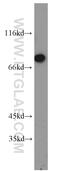 GLGB antibody, 20313-1-AP, Proteintech Group, Western Blot image 