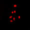 Estrogen Receptor 2 antibody, LS-C358984, Lifespan Biosciences, Immunofluorescence image 