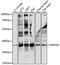 Radial Spoke Head 14 Homolog antibody, LS-C750400, Lifespan Biosciences, Western Blot image 