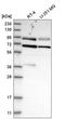 Segment polarity protein dishevelled homolog DVL-2 antibody, HPA021611, Atlas Antibodies, Western Blot image 