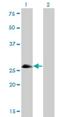 Achaete-scute homolog 1 antibody, H00000429-M01, Novus Biologicals, Western Blot image 