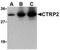 C1q And TNF Related 2 antibody, TA306281, Origene, Western Blot image 