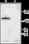 Potassium channel subfamily T member 1 antibody, GTX16697, GeneTex, Western Blot image 